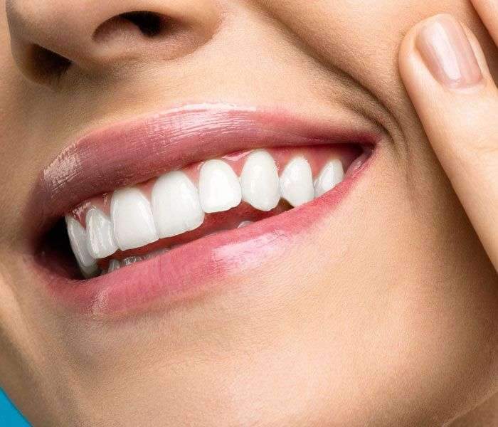 Carillas dentales, coronas de circonio y diseño de sonrisa en Santander